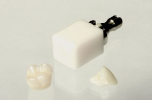 CEREC crowns block and tooth examples