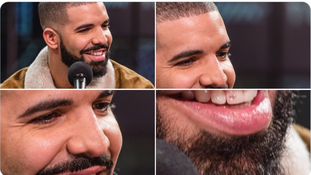 Images of Drake with his diamond studded tooth
